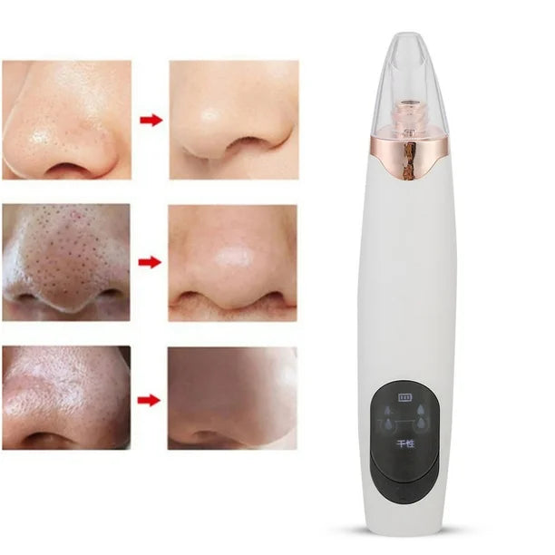 Bella Cleaner™  Succionador Facial 5‑en‑1  Limpieza Profunda y Suave