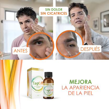 Tag Off Solución Verrugas y Carnosidades